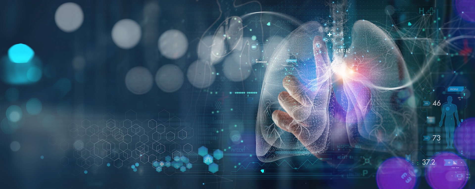 Artwork of lungs, data, and a doctor's hand  that represents pulmonary telemedicine.