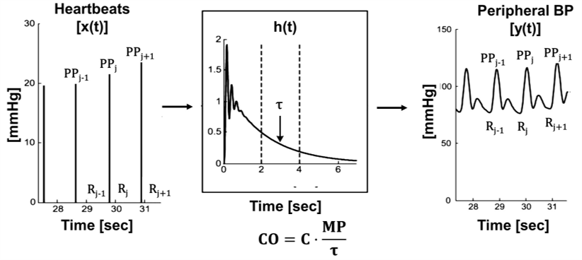 BP waveform analysis