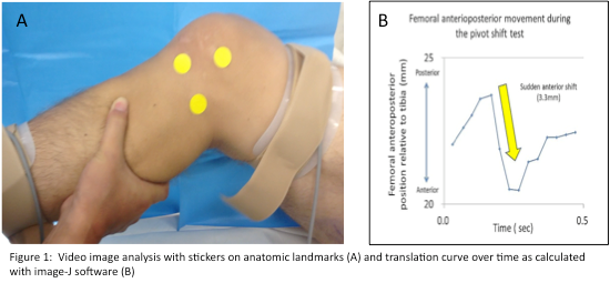 anatomical limb analysys