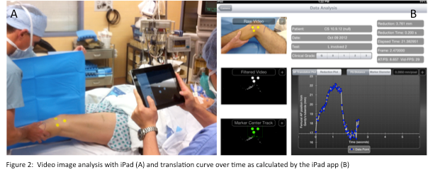 imaging with an ipad, limb translation