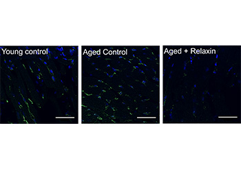  macrophage accumulation comparison imagery
