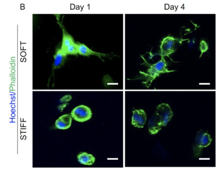 Hoechst/Phalloidin images of stiff and soft examples on Day 1 and Day 4