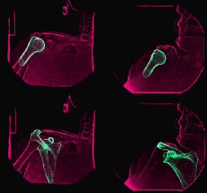 RC Kinematics