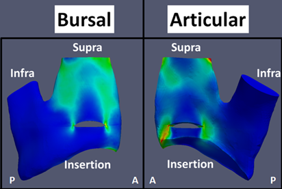 Tendon Model