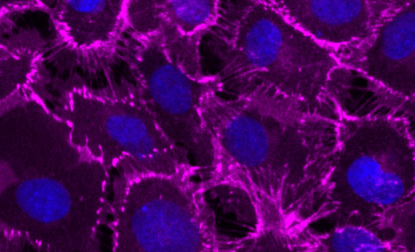 Mesothelial cells cover the surface of the organs in the abdominal cavity.