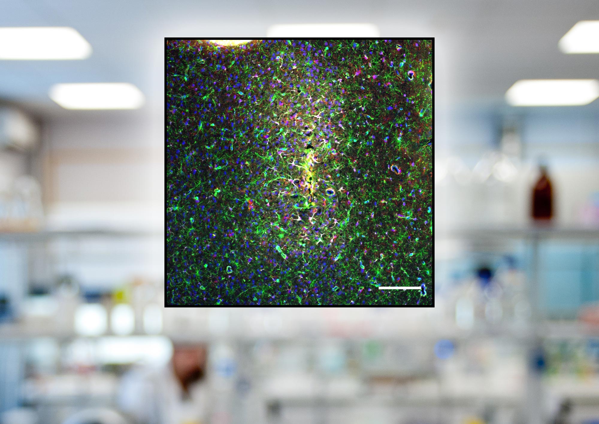 OPC activation around Chronic Brain Implant