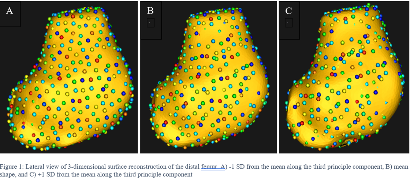 statistical shape modeling