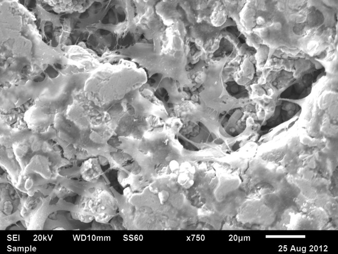 SEM image of fixed MC3T3 pre-osteoblast cells seeded directly onto a 3D printed iron alloy scaffold after 3 days of culture, showing cells infiltrating into the open porosity. Project conducted in collaboration with Dr. Kuhn and Ex One Company