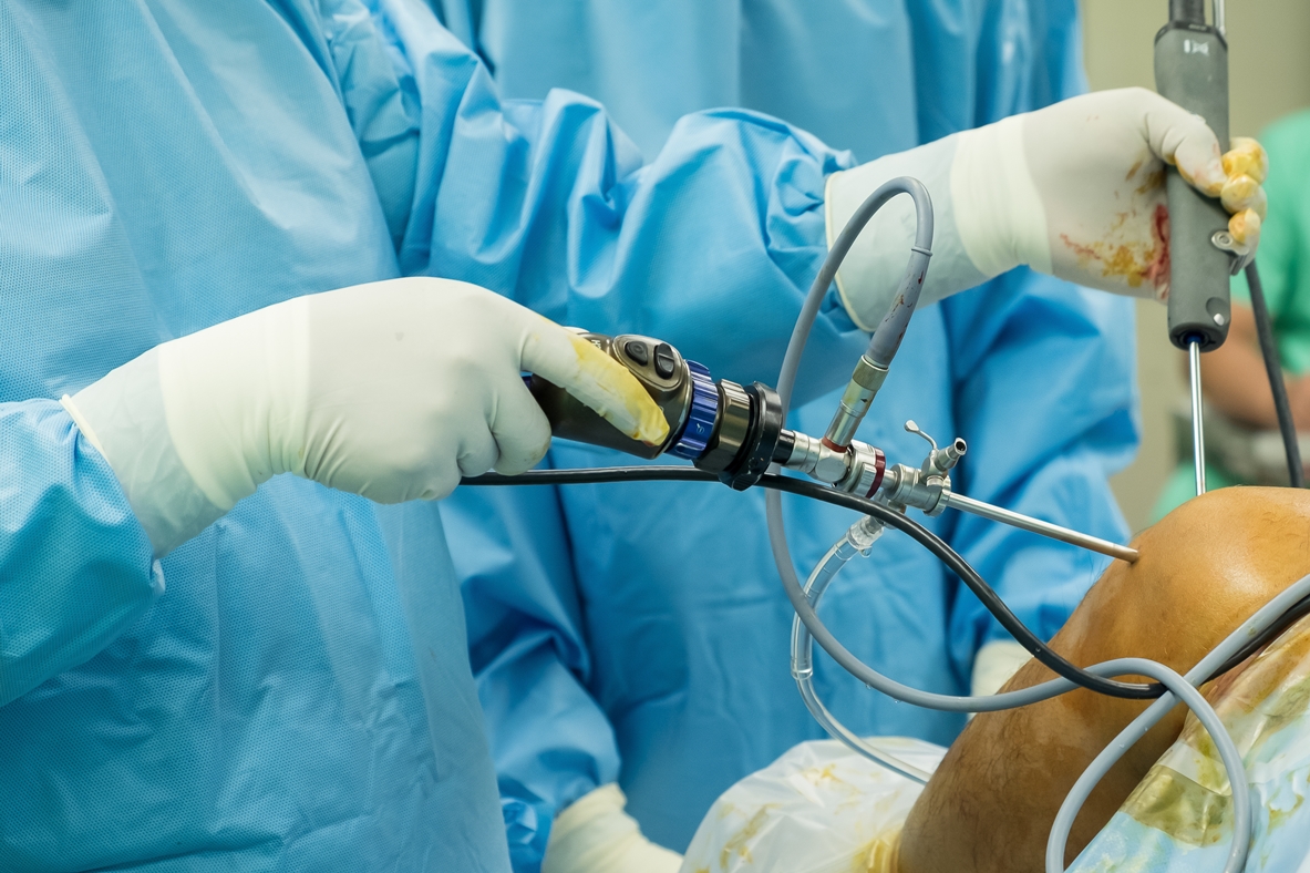 arthroscope surgery