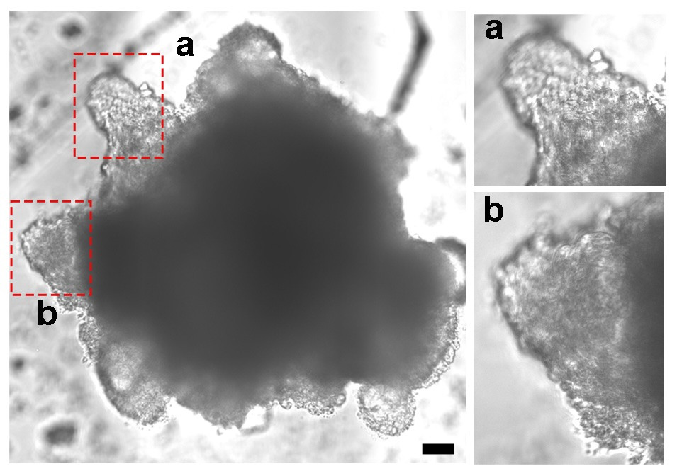 Photography by Yuanhang He/University of Pittsburgh; an assembloid made out of heart cells. Heart valve structures are highlighted in the red boxes.