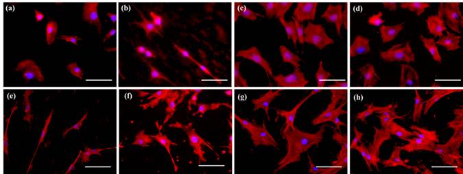 Cell morphology of MC3T3 osteoblasts (a-d) and hMSCs (e-h) observed at 24 hours post seeding through actin-nucleus co-staining on uncoated AZ31 (a & e), PCL (b & f), PLGA 50:50 (c & g) and PLGA 75:25 (d & h)