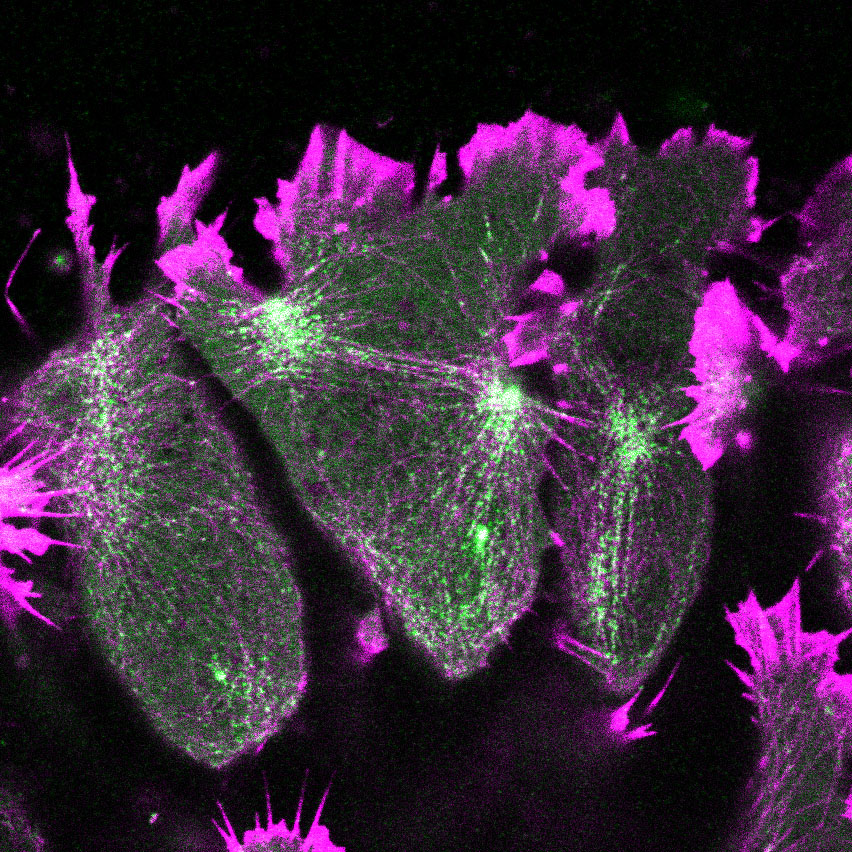 ImageJ=1.53c unit=micron finterval=10 