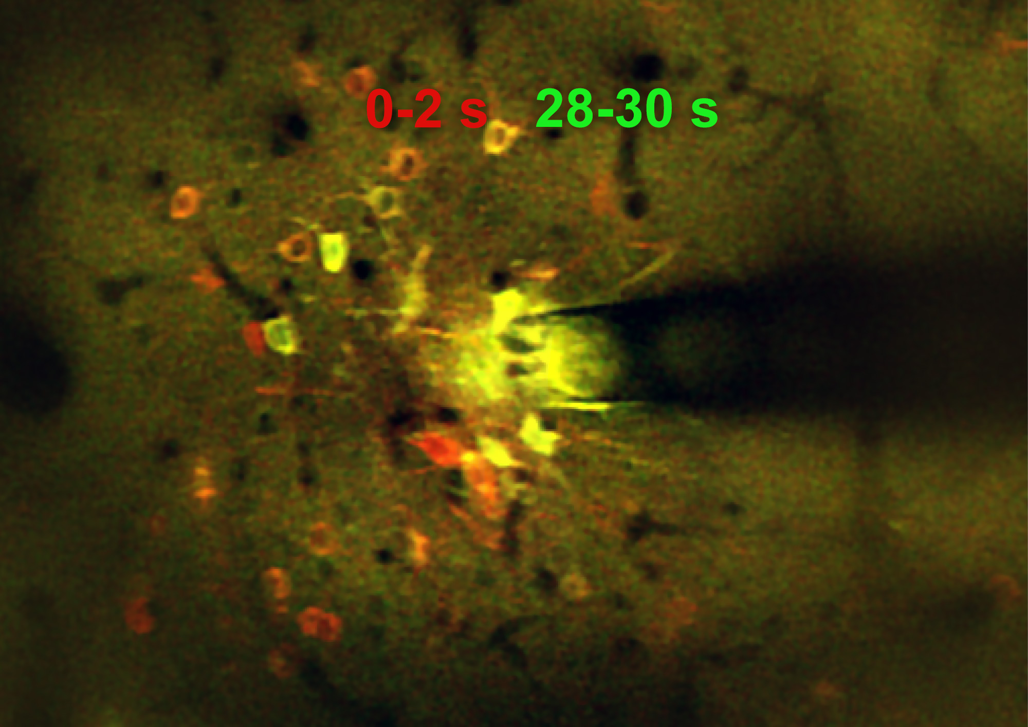Microscopic image of Neurons