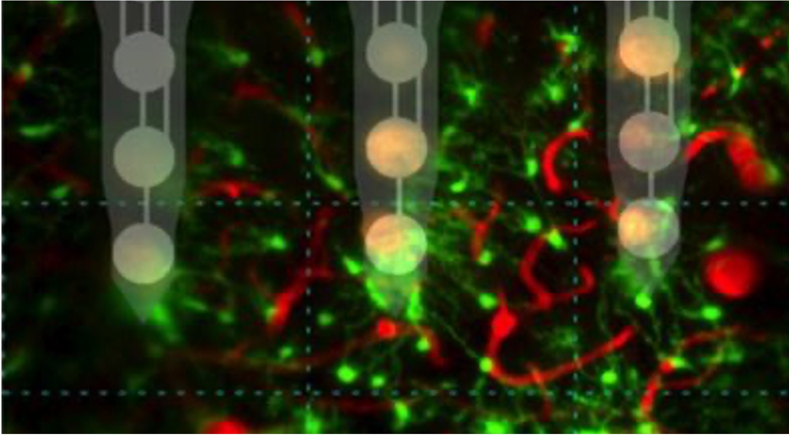 graphic illustration of neural electrode-tissue interface