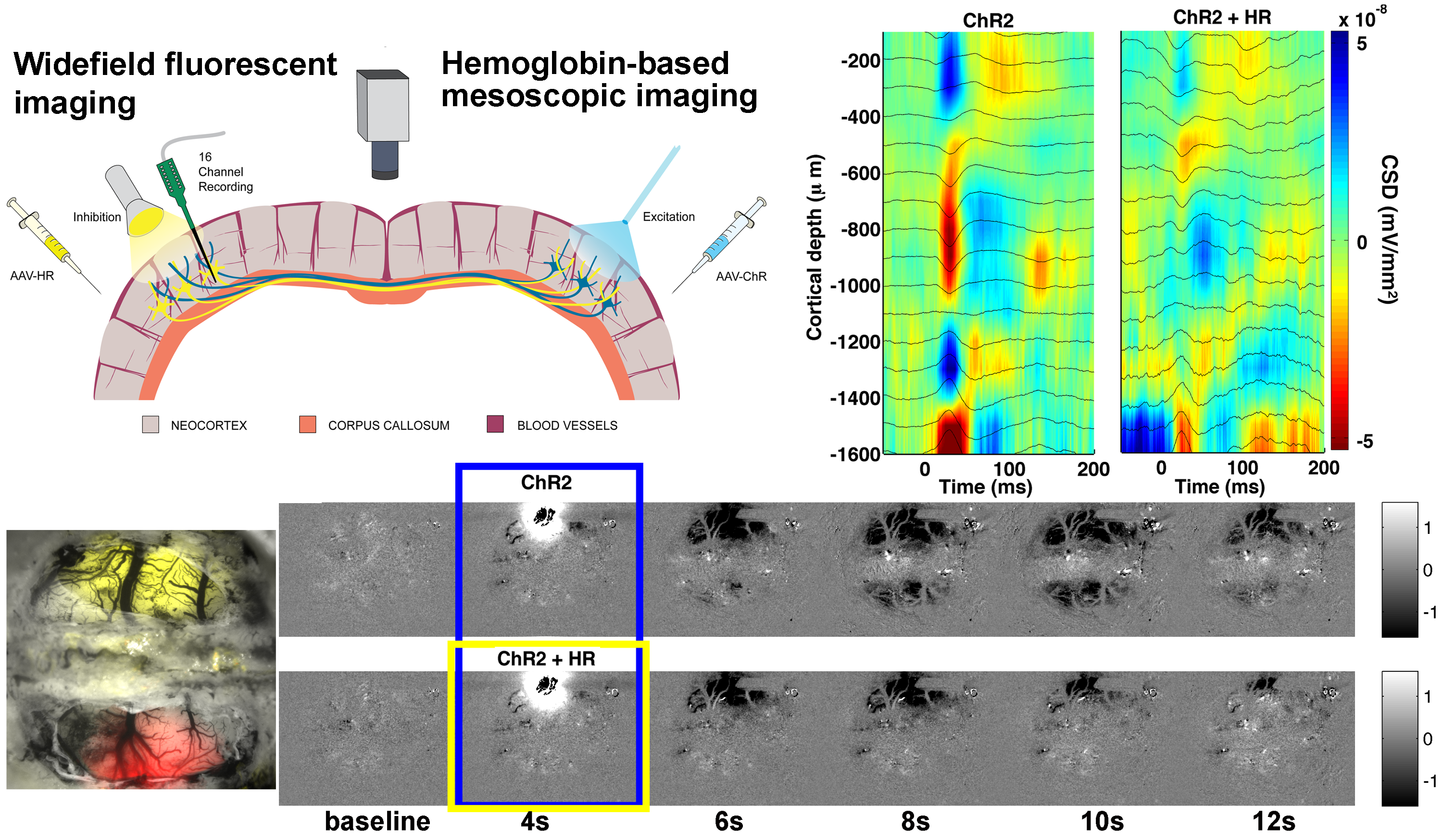 optical imaging and electrophysiology of left – right brain neurovascular coupling 